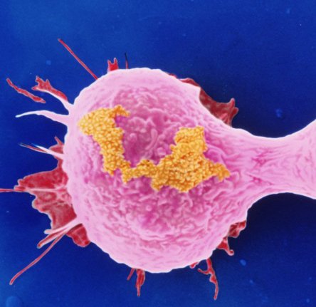 Dividing Breast Cancer Cells